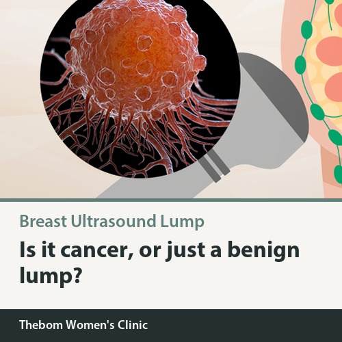 A Lump Was Found on Breast Ultrasound: Should You Worry Right Away?
